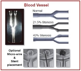 Blood Vessel