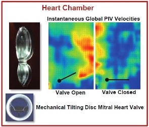 Heart Chamber